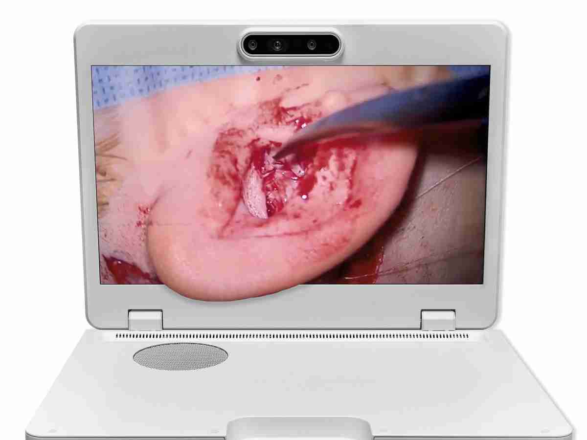 达擎之＂Heads-up 3D显微手术显示系统＂，，整合4K裸眼3D显示及眼球追踪系统，，具备快速追踪人眼移动位置功能，，减轻医师长时间维持固定姿势的负担，，让医师能有更宽广清晰的3D立体视野及更舒适的姿势来执行手术。。。。